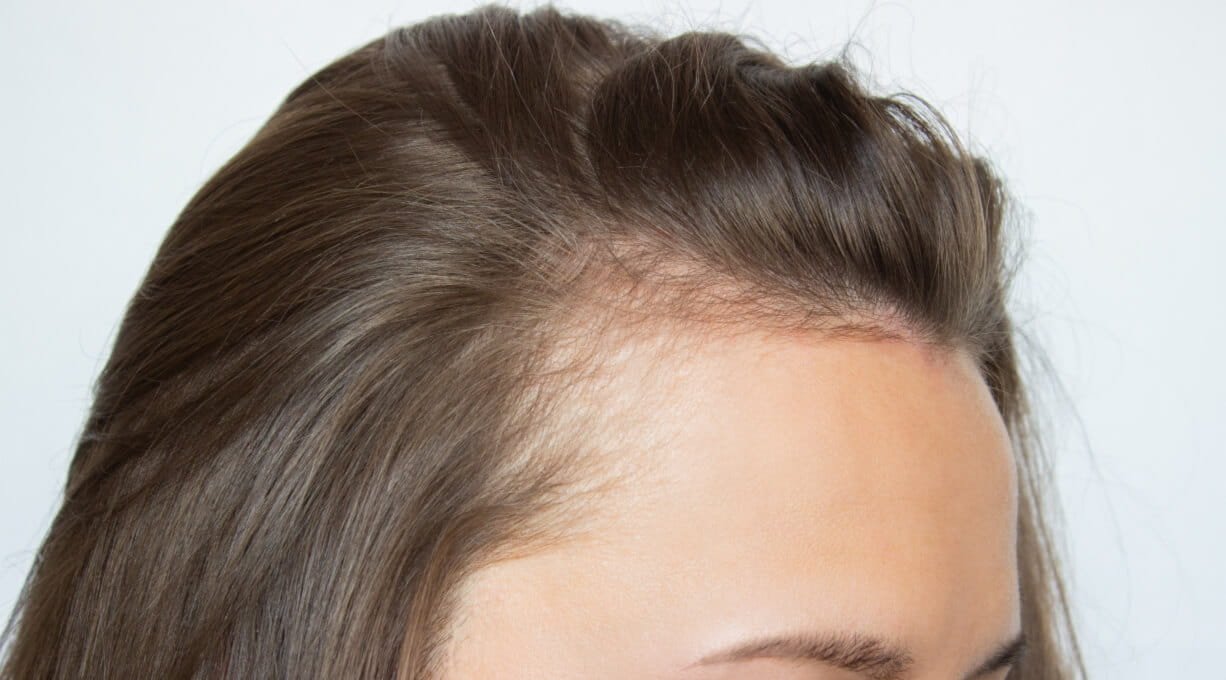 Widoczne baby hair na zakolach