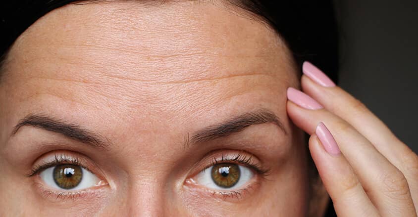 Zmarszczki mimiczne na czole