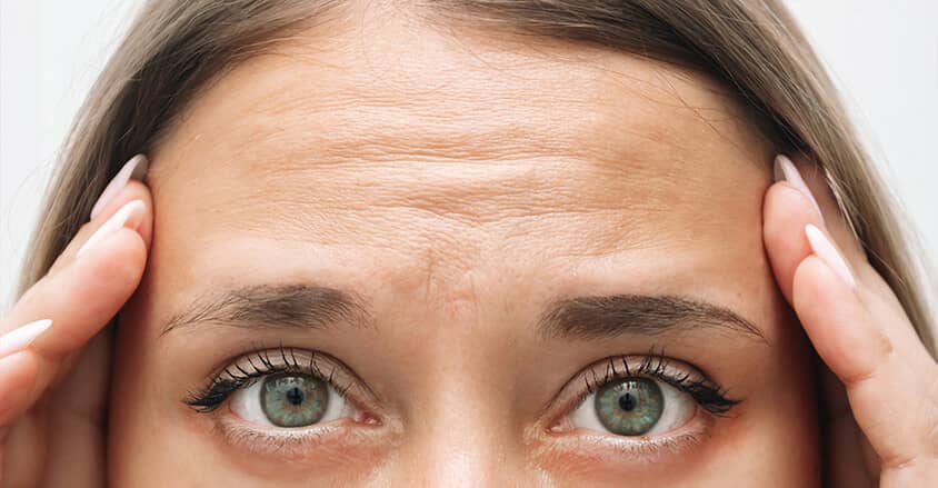 Widoczne zmarszczki na czole u młodej kobiety