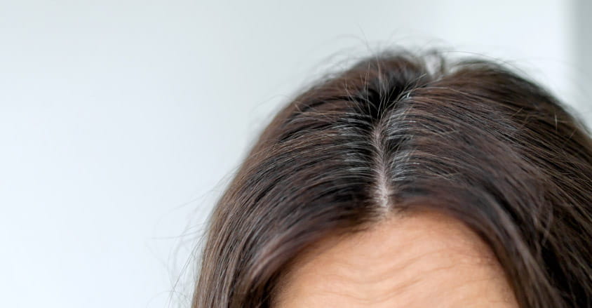Odstające włosy na czubku głowy.