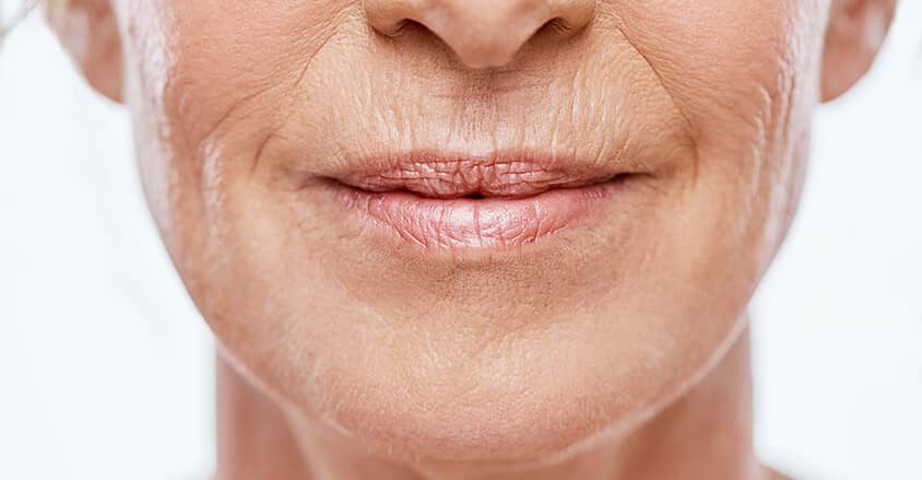 Zmarszczki palacza widoczne nad górną wargą